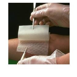 GARZA MEDICATA BACTIGRAS CON CLOREXIDINA ACETATO 0,5% 10X10CM 10 PEZZI - Farmacia Sant Anna SAS del Dott. Mariani Federigo